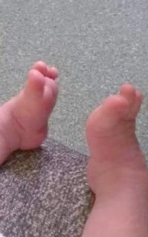 Pomagamy małemu Antosiowi, który musi przejść kolejną poważną opereację w swoim krótkim życiu by móc normalnie żyć, bez bólu!