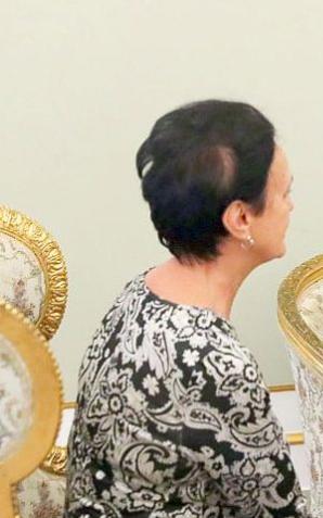 O pomocy dla chorych na stwardnienie rozsiane