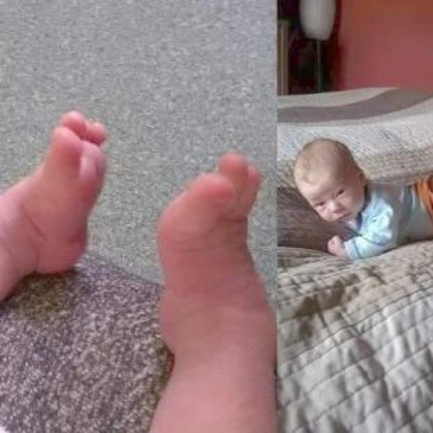 Pomagamy małemu Antosiowi, który musi przejść kolejną poważną opereację w swoim krótkim życiu by móc normalnie żyć, bez bólu!